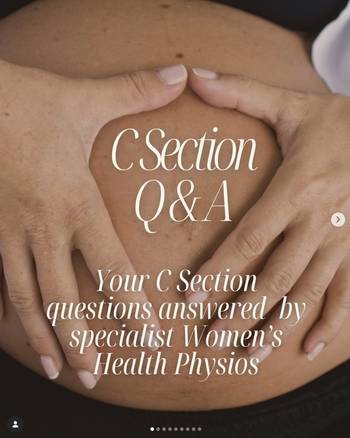 Close-up of a person's chest with hands framing the C section scar, overlaid with text 'C Section Q&A Your C Section questions answered by specialist Women's Health Physio.'