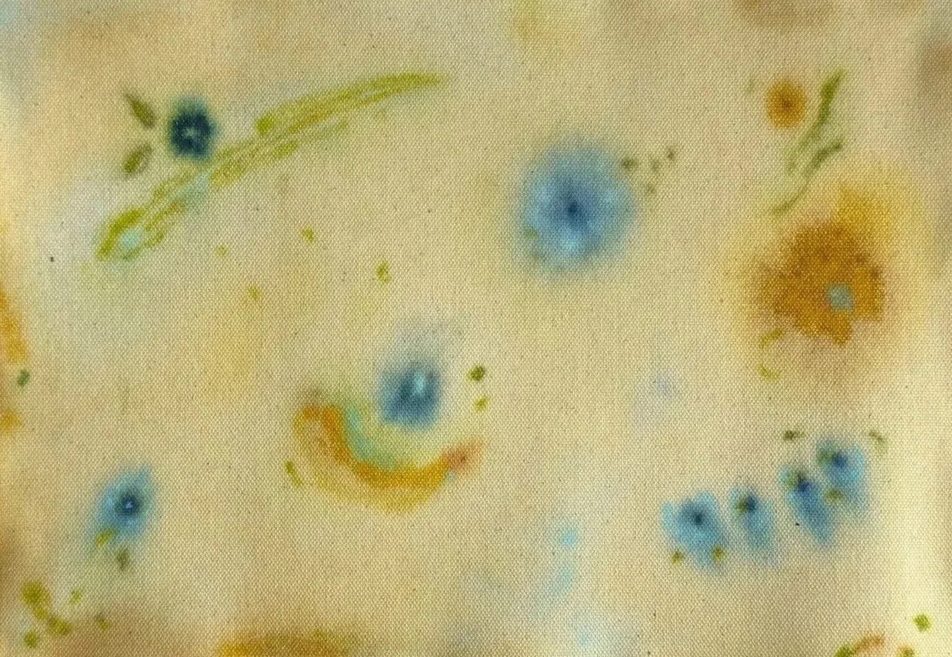 Microscopic view of bacteria with various shapes and colors, including blue, yellow, and brown, on a light background.
