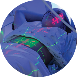 Radiation Therapy