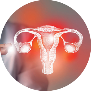 Gynecologic Oncology