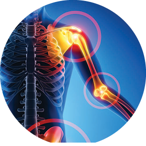 Orthopedics