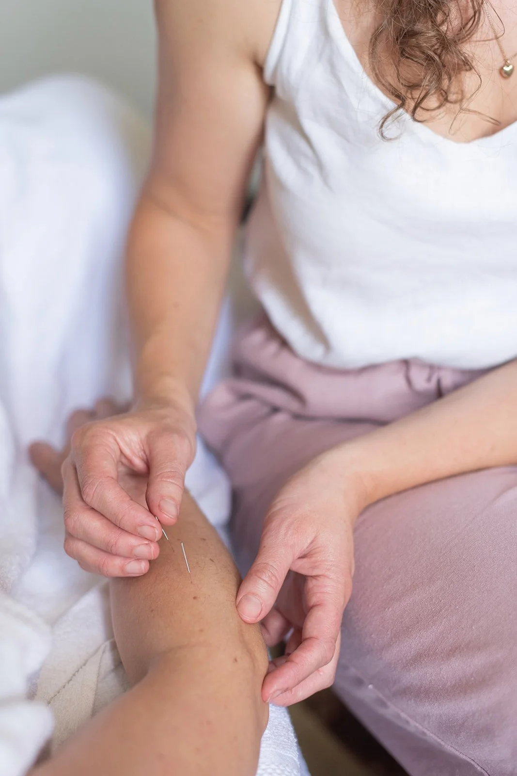 A woman performing dry needling on a person's arm, inserting a thin needle into the skin to reduce chronic pain.
