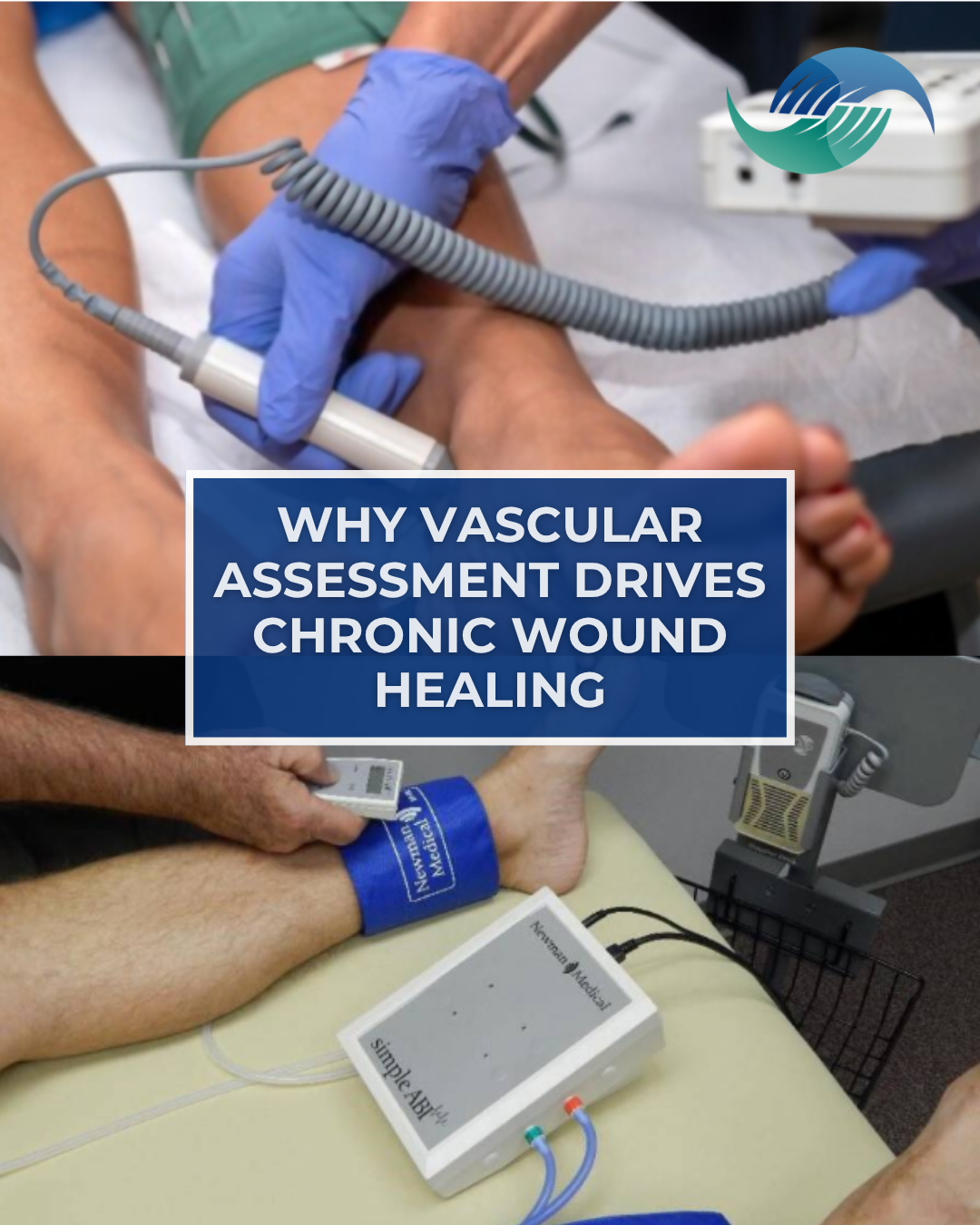 The Test Too Often Missed: Why Vascular Assessment Drives Chronic Wound Healing&nbsp;