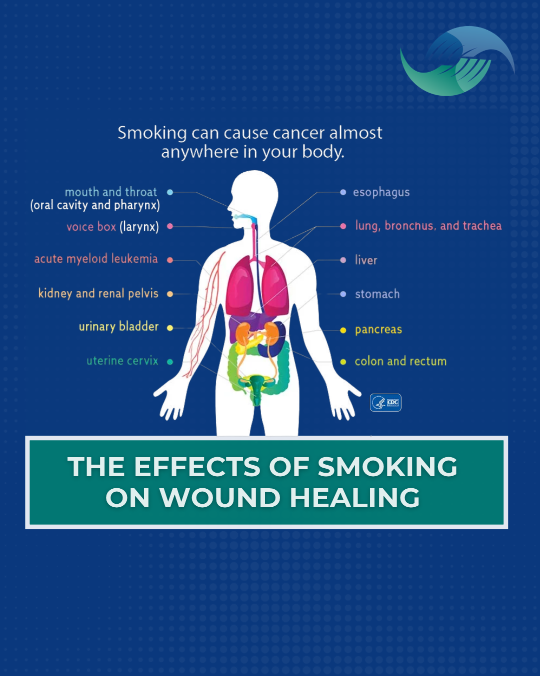 The Effects of Smoking on Wound Healing&nbsp;
