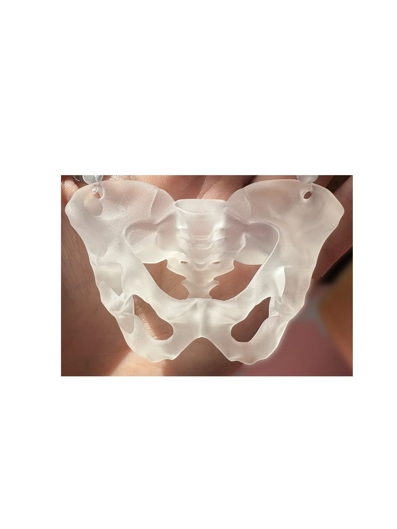 transparent pelvis.jpg