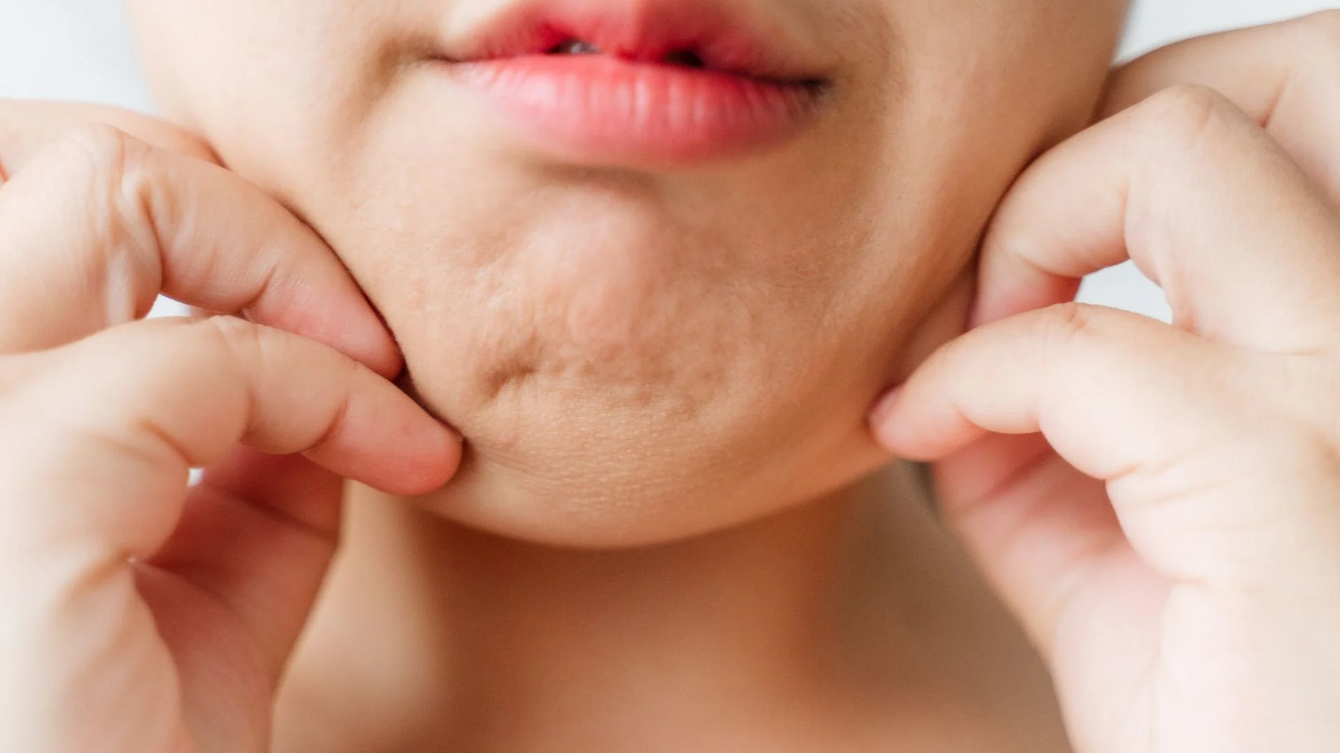 Why Is My Face Puffy? A Functional Medicine Look at Face Puffiness, Hormones, Gut Health and Fluid Retention