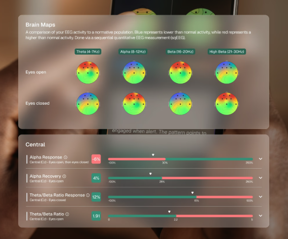 Neurofeedback: Retraining Your Brain for Better Focus, Sleep and Stress Resilience
