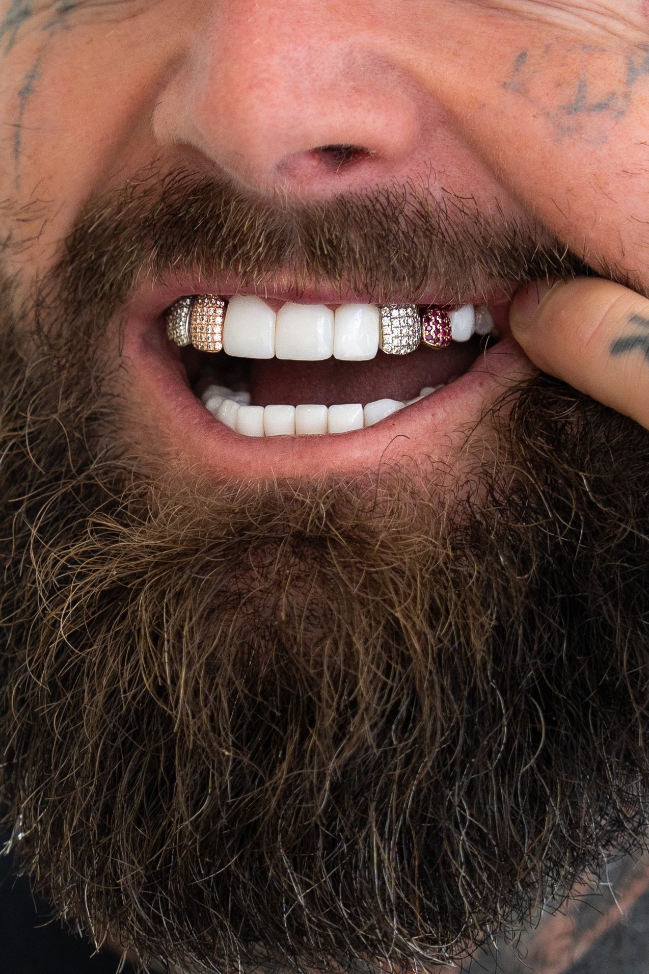 Close-up of a smiling man's mouth showing white teeth with diamond and ruby grillz, a beard, and a mustache.