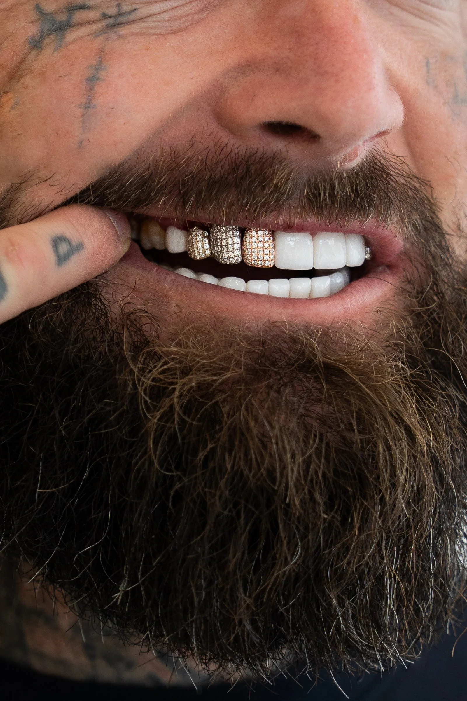 A man with a beard showing off his diamond-encrusted gold teeth, with a tattoo on his finger touching his lip.