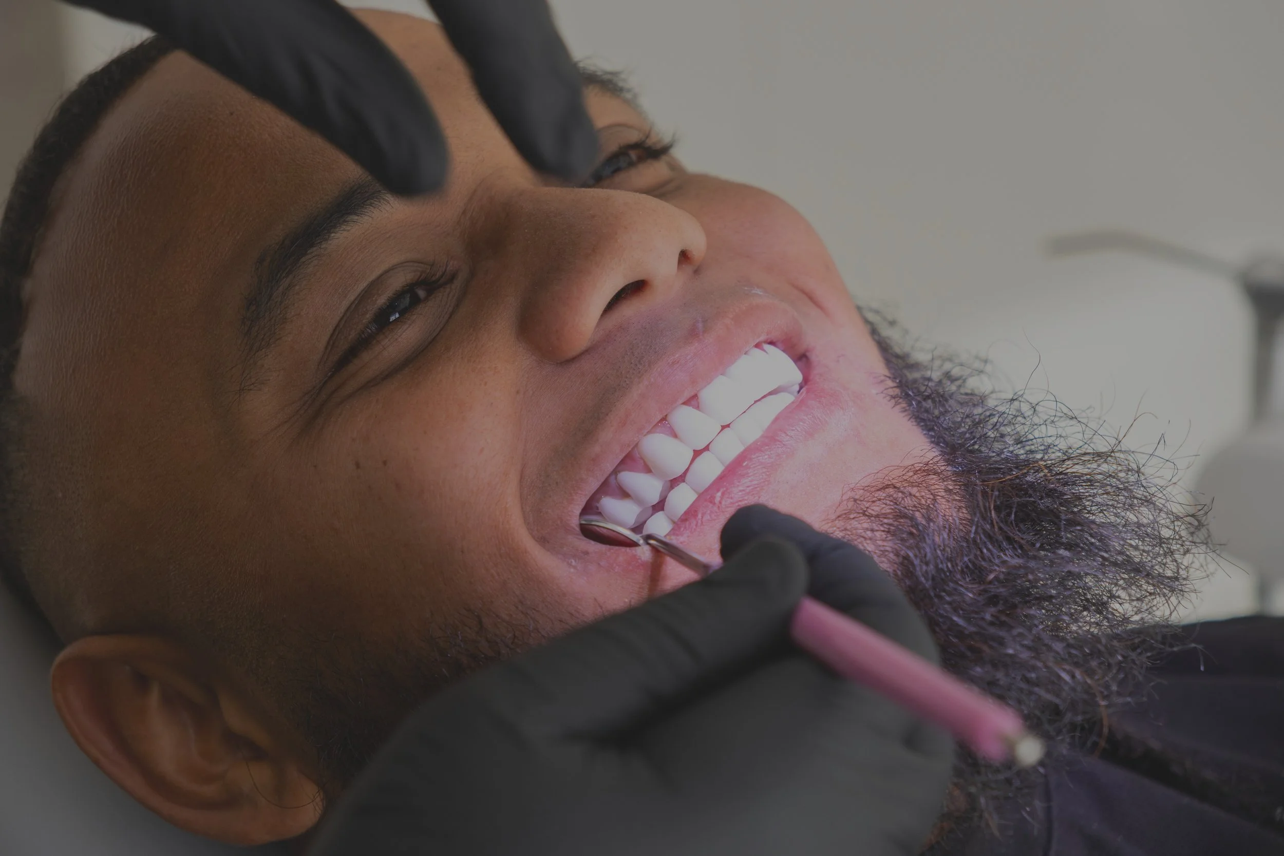 SMILE MAKEOVER