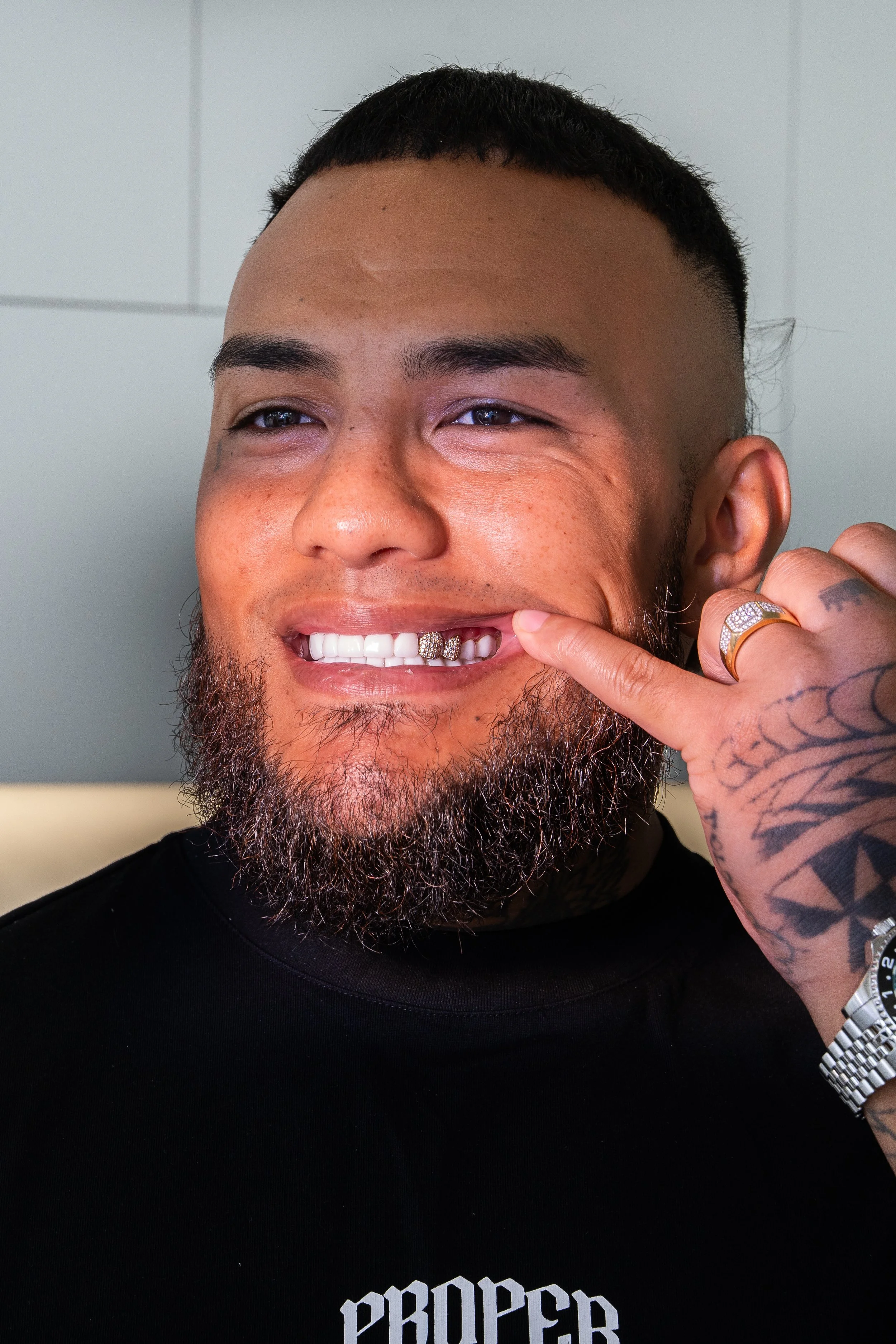 A man with a beard and tattoos is smiling and pointing at his mouth, showing his grillz or dental jewelry.