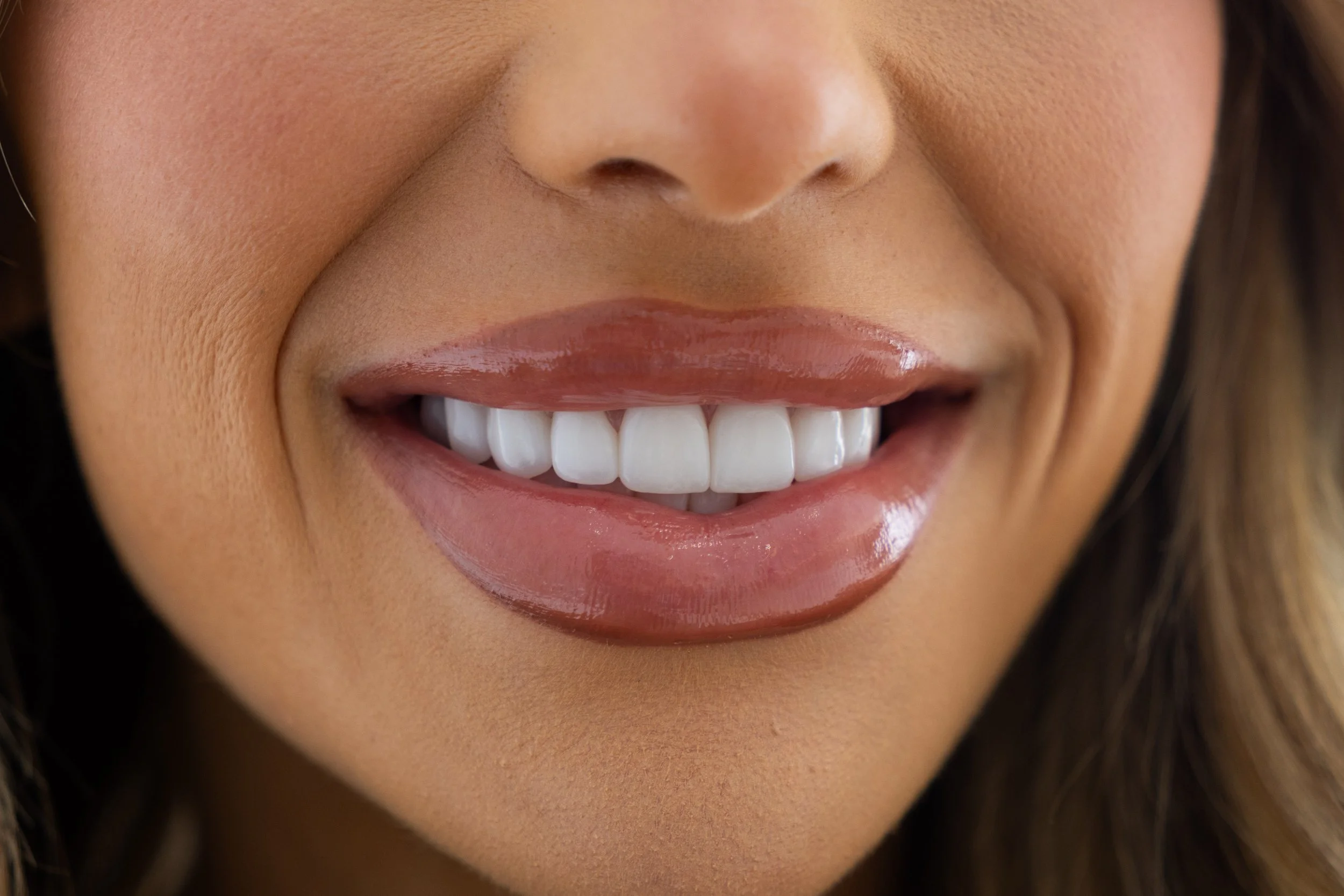 A close-up of a woman's smiling mouth showing white teeth, glossy pink lips, and smooth skin.