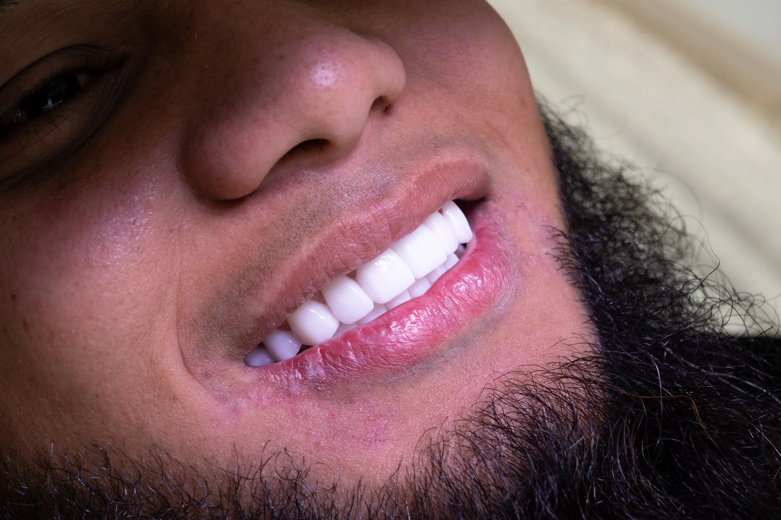 Close-up of a smiling person's face, showing teeth and lips, with facial hair and a portion of an eye visible.