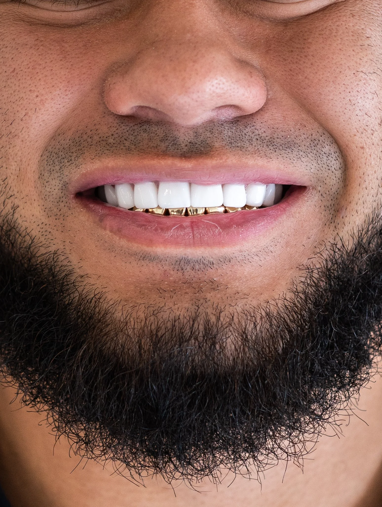 Close-up of a smiling man with a beard, showing teeth with gold grills.