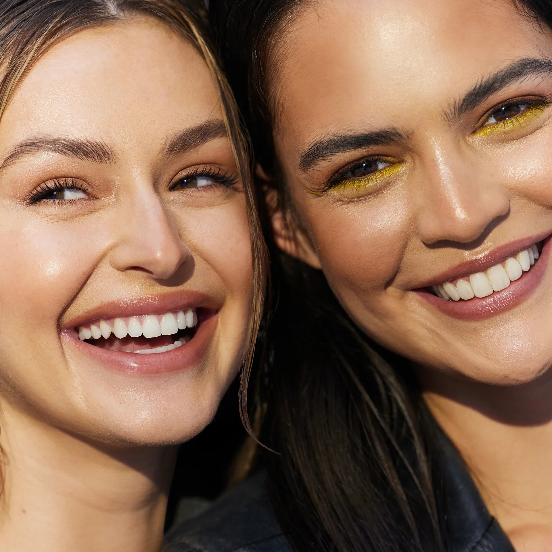 Composite and Porcelain Veneers at The Thirty Two, a cosmetic and general dentist in Southport, Gold Coast 1