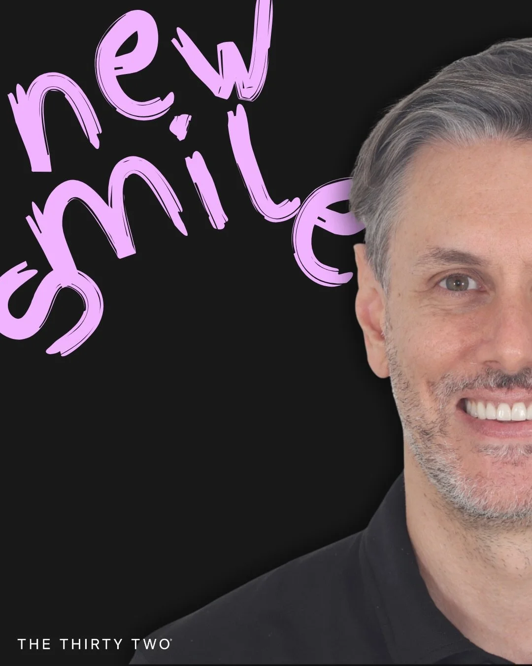 New smile, new confidence. 

Featuring 6x Tier 1 Porcelain Veneers.

#thethirtytwo #dentalstudio #goldcoast #brisbane #porcelainveneers #smilegoals #veneers