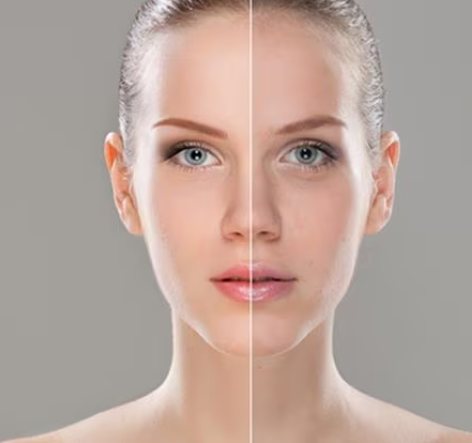 Split image of a woman's face showing a comparison of skin with and without makeup, against a gray background.
