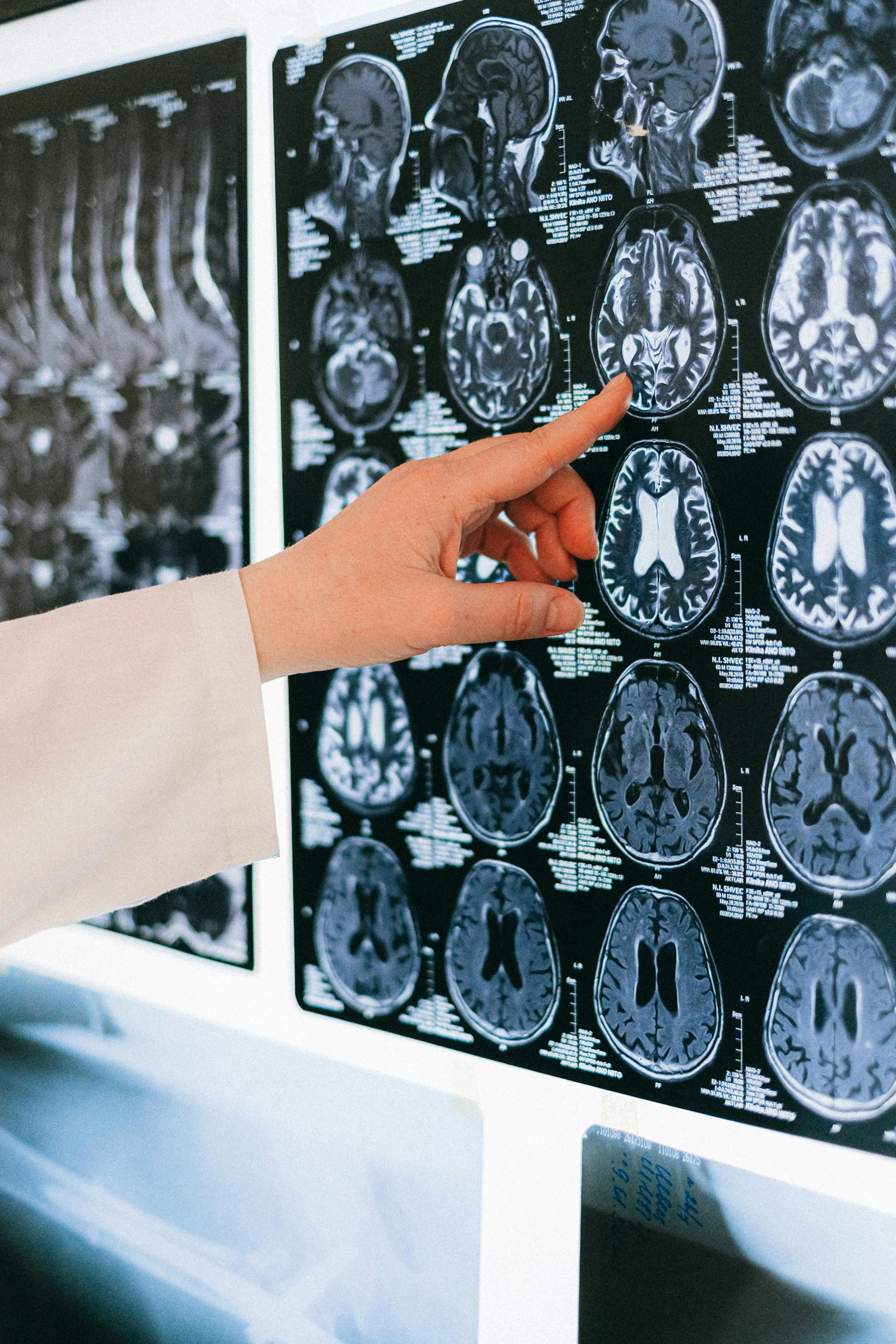 Your Gut is talking to your Brain — Is anyone listening?