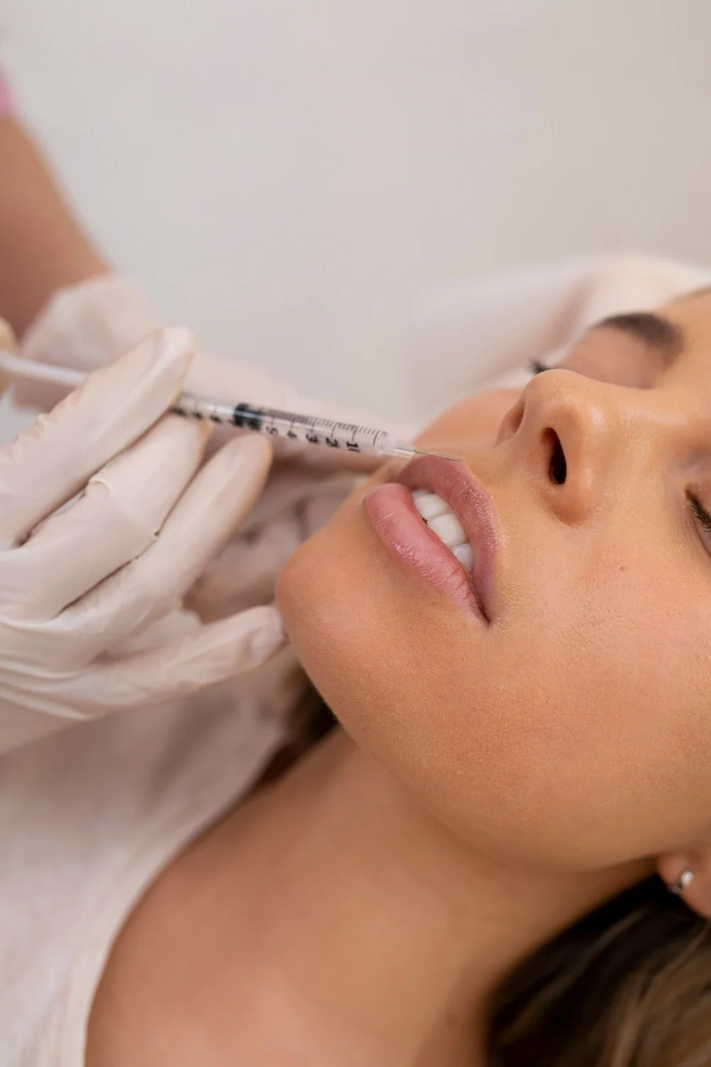 Close-up of an aesthetic injector giving a lip filler injection to a woman lying back