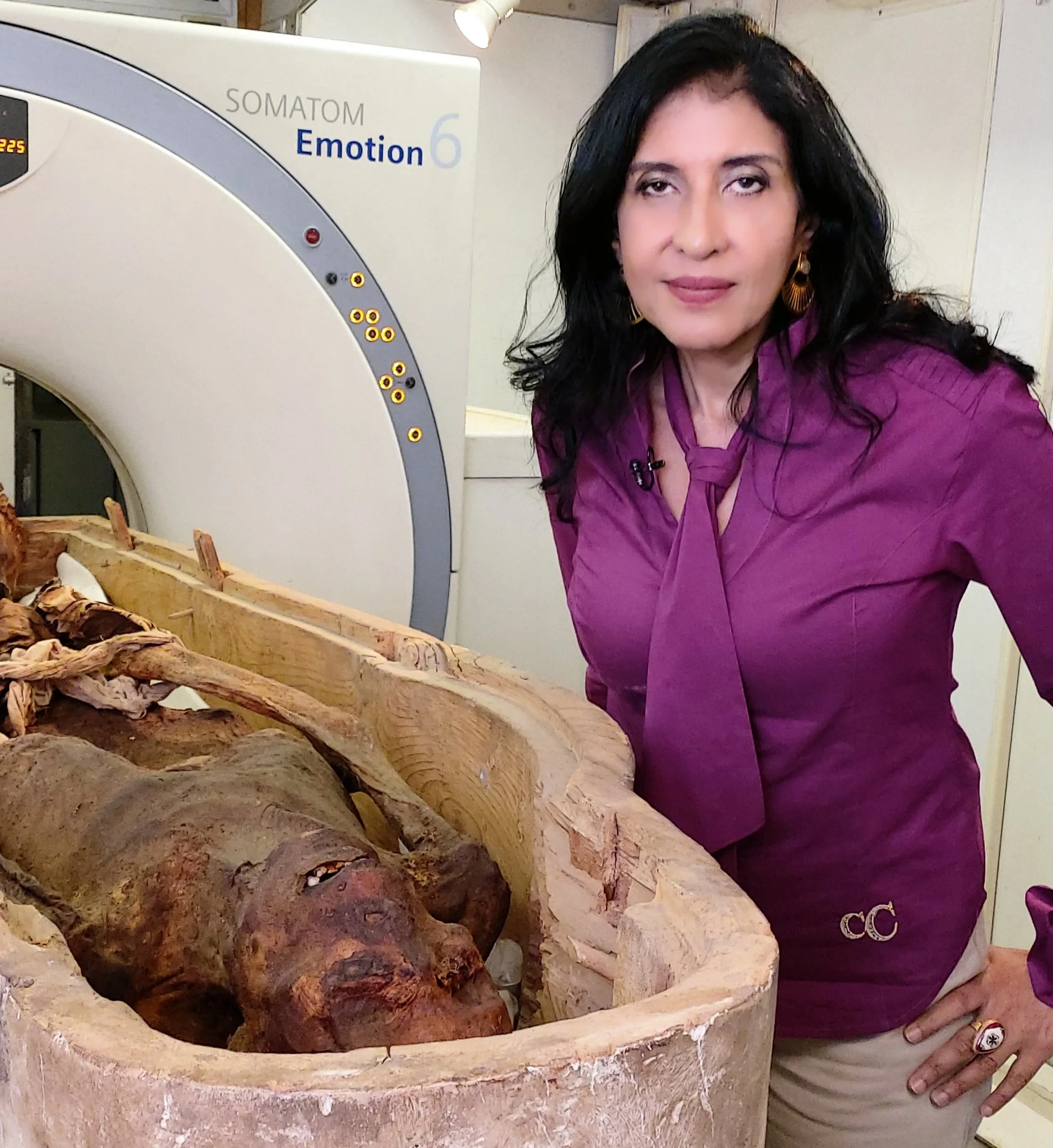 In March 2021, Professor Dr. Sahar Saleem used advanced AI-assisted CT imaging to study an ancient Egyptian mummy, helping confirm its royal origin as Prince Pentawere, the son of Pharaoh Ramesses III.