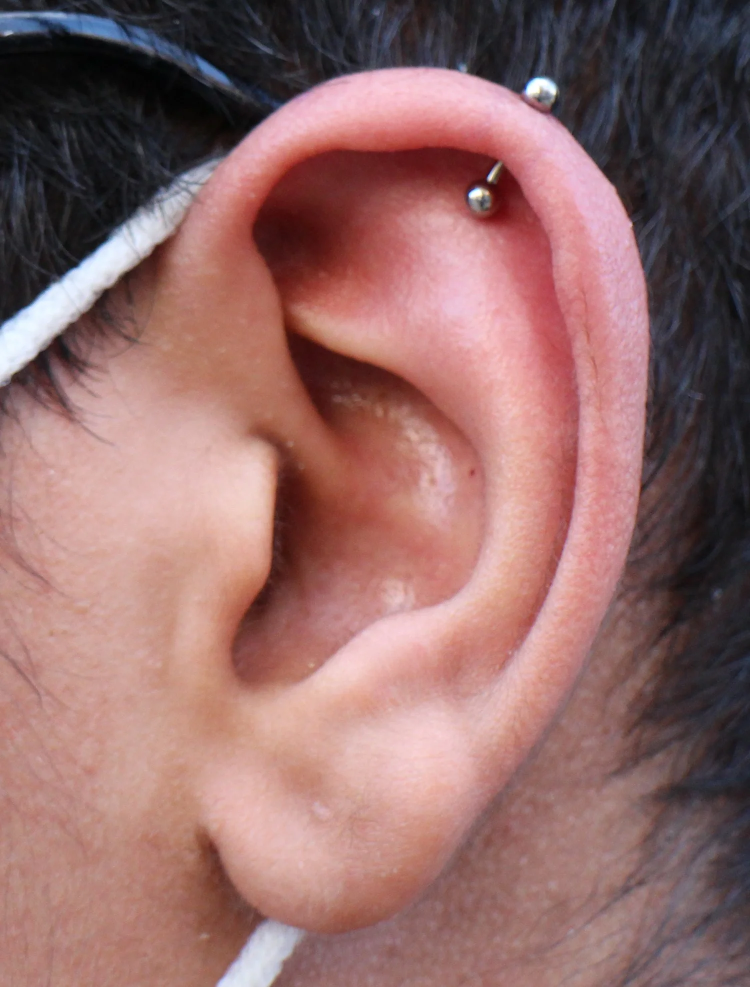 Vertical Helix with Titanium balls on both sides