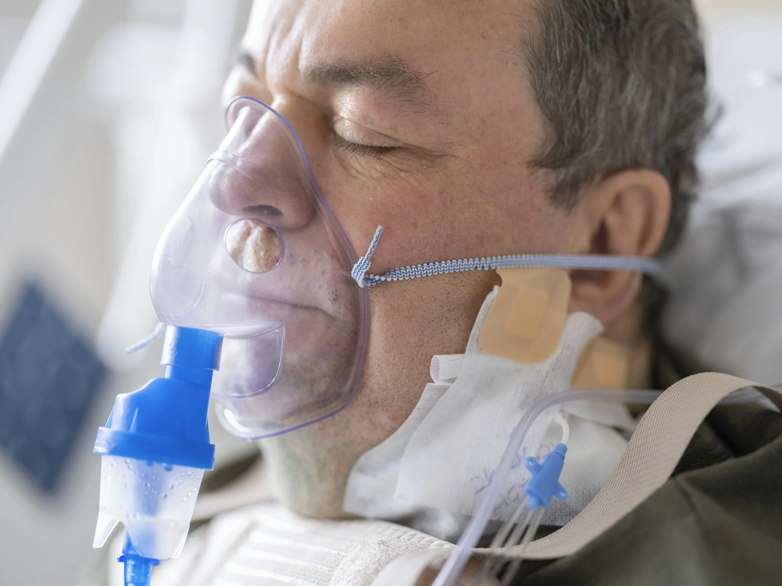 Close-up of a man with short gray hair, wearing a face mask and a nasal oxygen tube, resting with eyes closed.