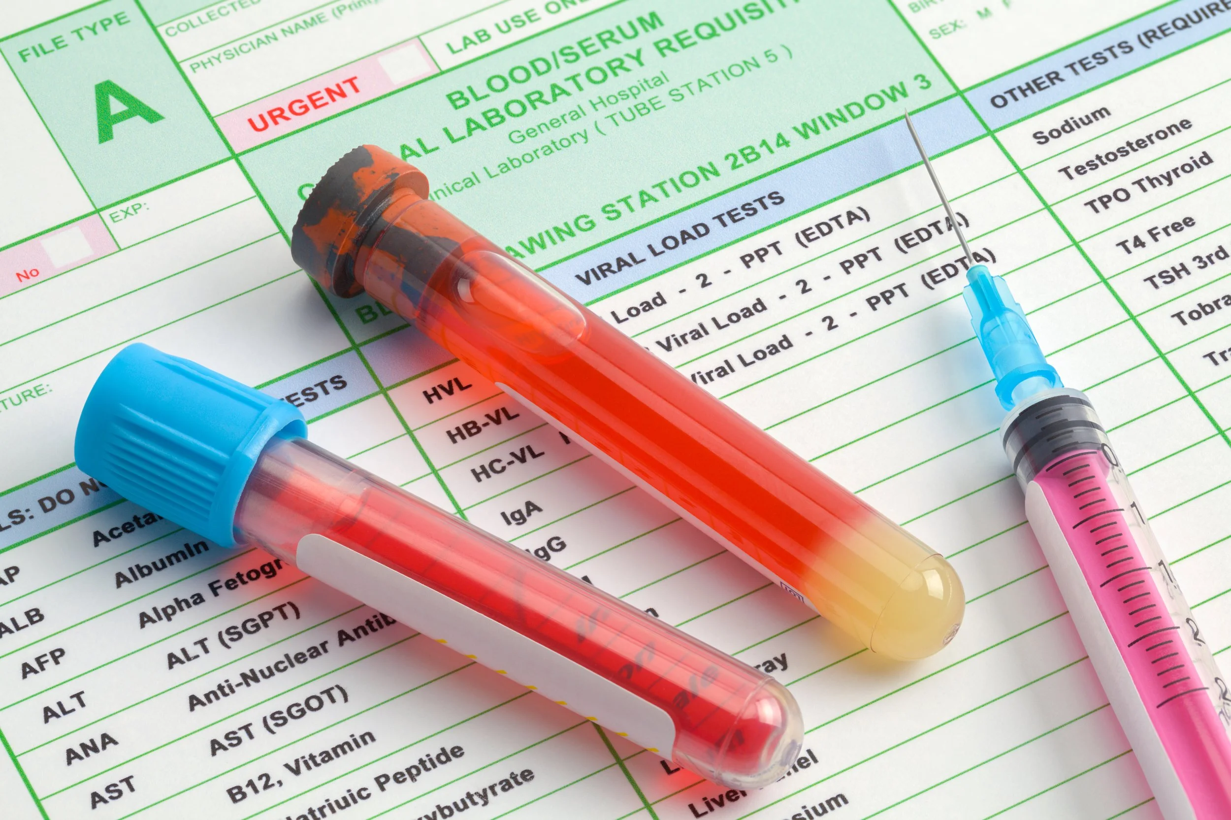 Medical laboratory report with three blood collection tubes on top.