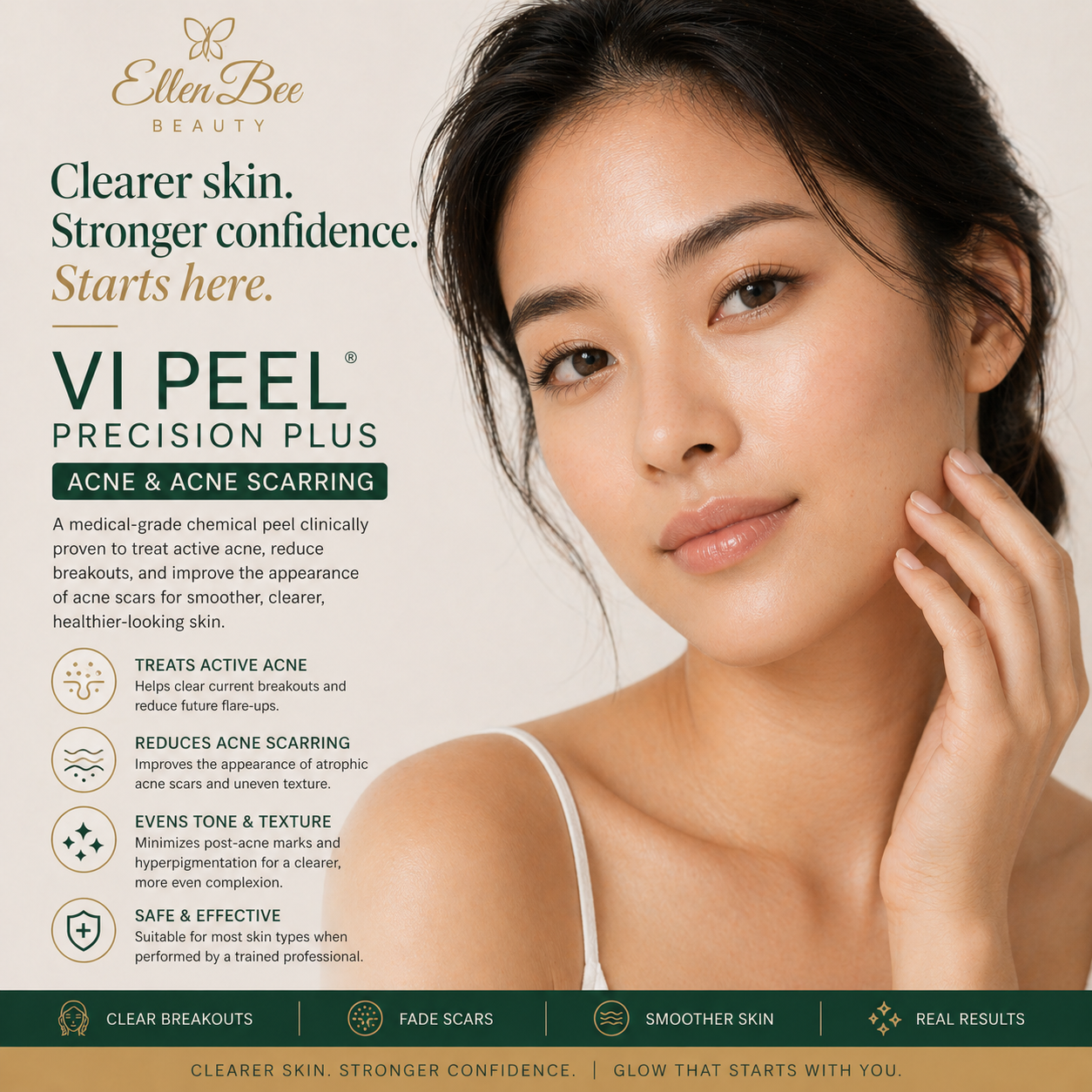 VI Peel Purify w/Precision Plus (Acne & Acne Scaring)
