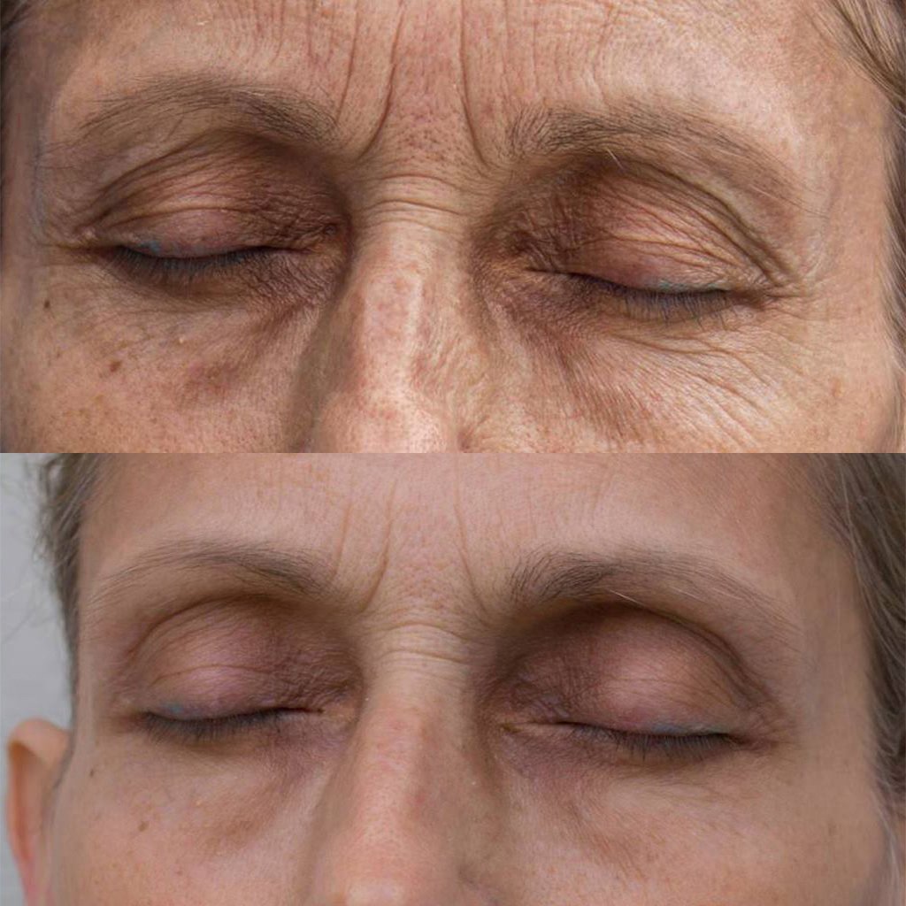 TG Disappearing Wrinkles.jpg