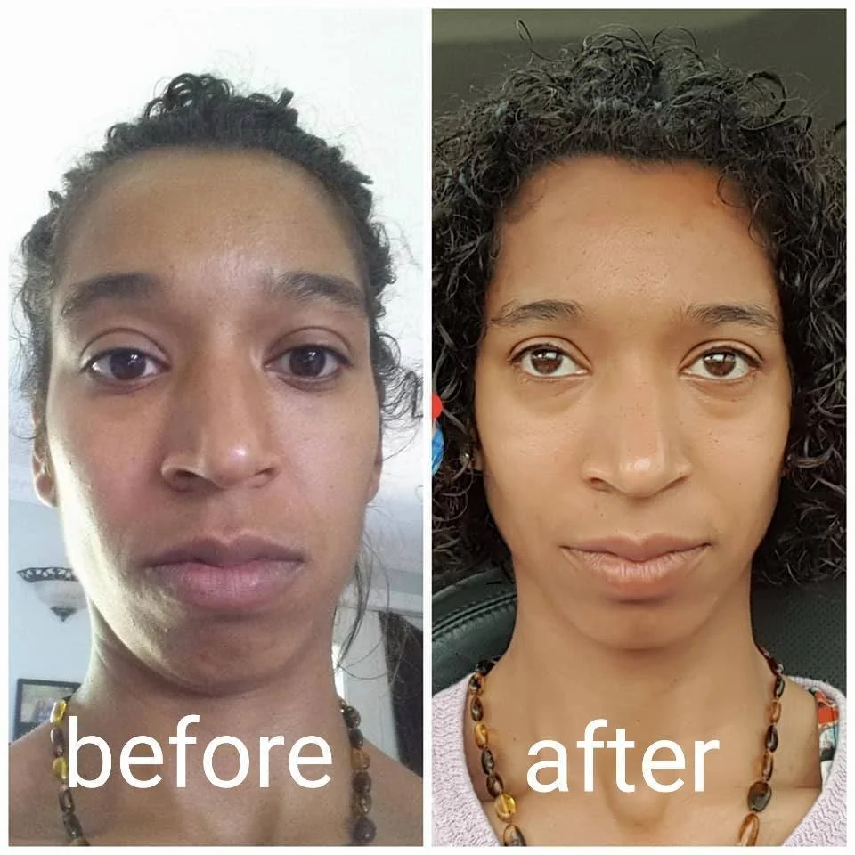 TG Graves Skin Tone Facial Realignment.jpg