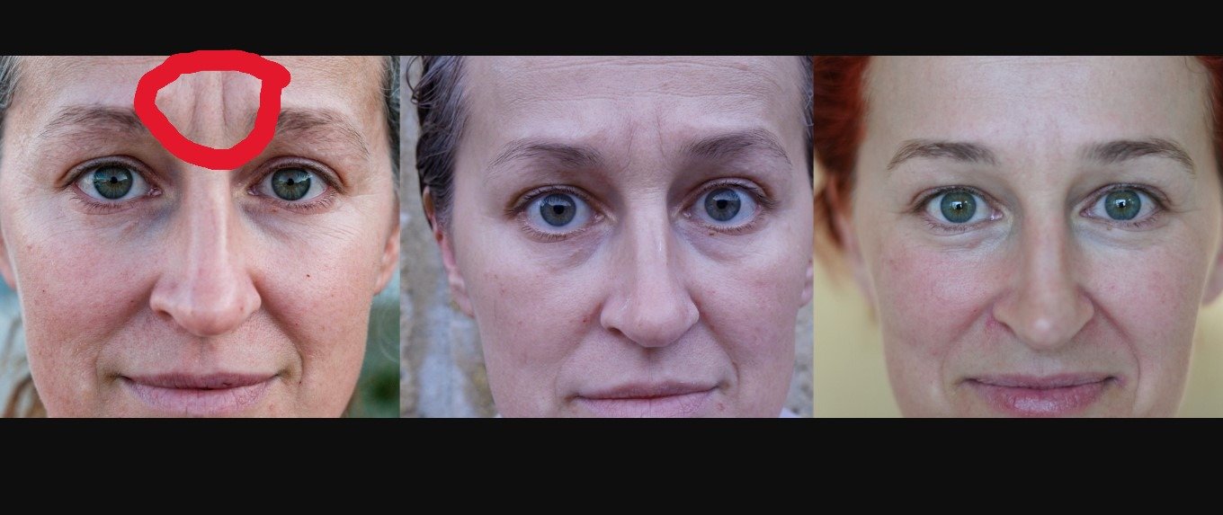 TG Arsenic Iodide reversal.JPG