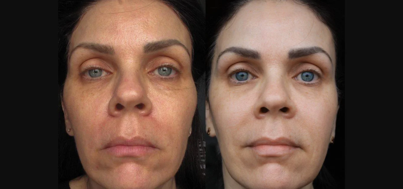 TG B&A.jpg
