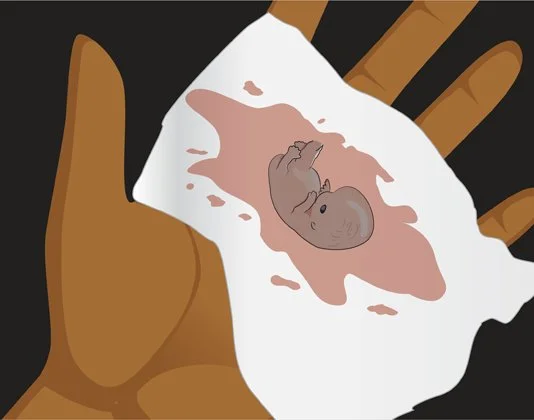 A hand holding a tissue with a drawn image of a tiny fetus on it.