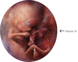 Fetal ultrasound image showing a developing baby at 10 weeks gestation inside the womb.