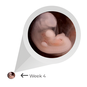 Ultrasound image of a developing fetus at 4 weeks gestation