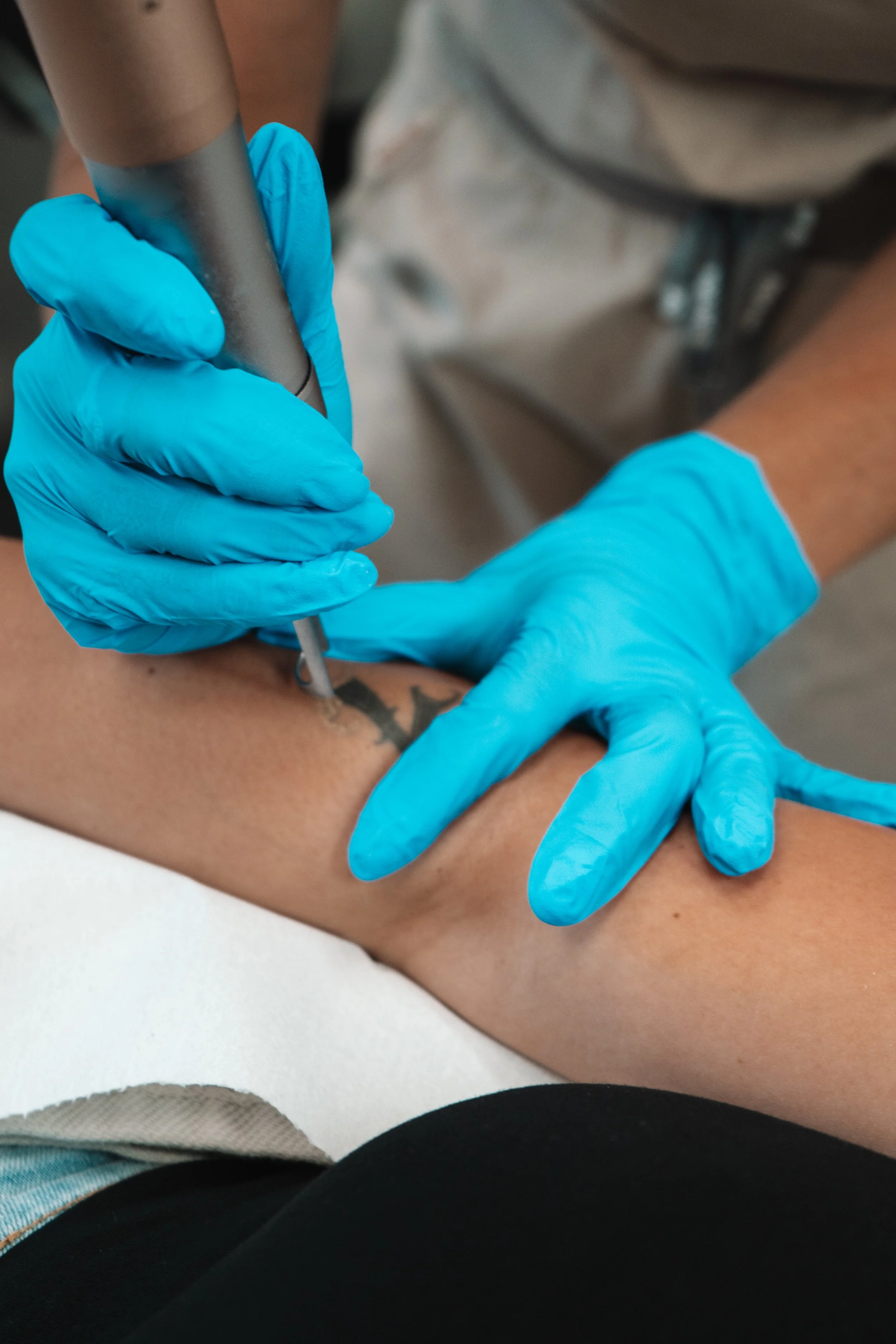 A person wearing blue gloves is tattooing a person's arm with a tattoo machine. The tattoo appears to be a black design.