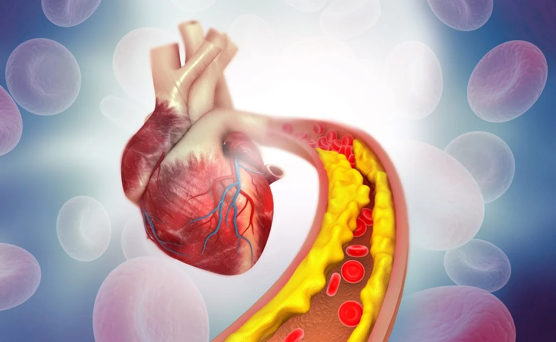 Corvidia Therapeutics: From Early Stage to Acquisition