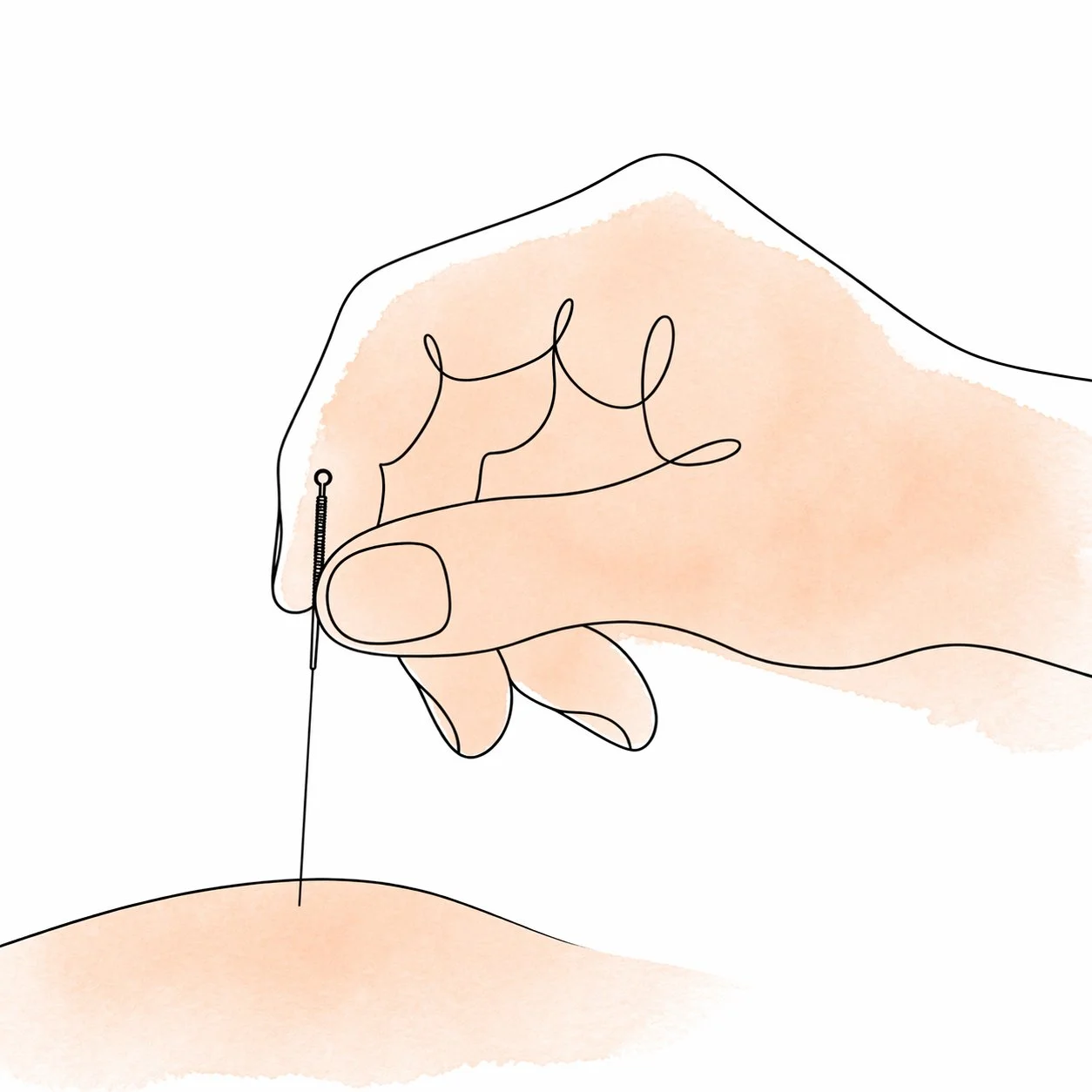 Minimalist illustration of a hand holding an acupuncture needle over acupuncture point.