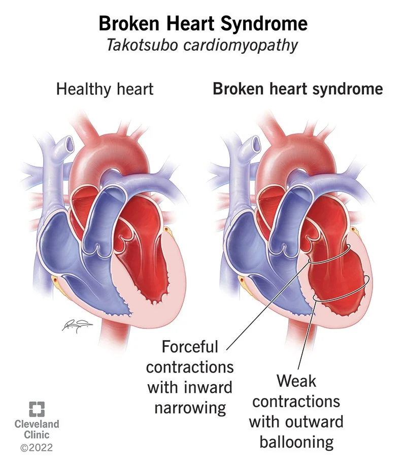 Can you really Heal from a Broken Heart?