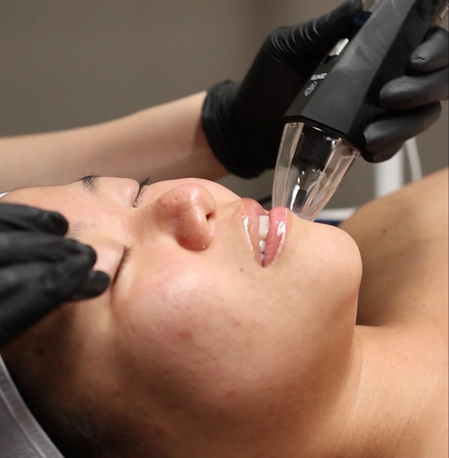 Person receiving a facial treatment with a device from a practitioner wearing black gloves.