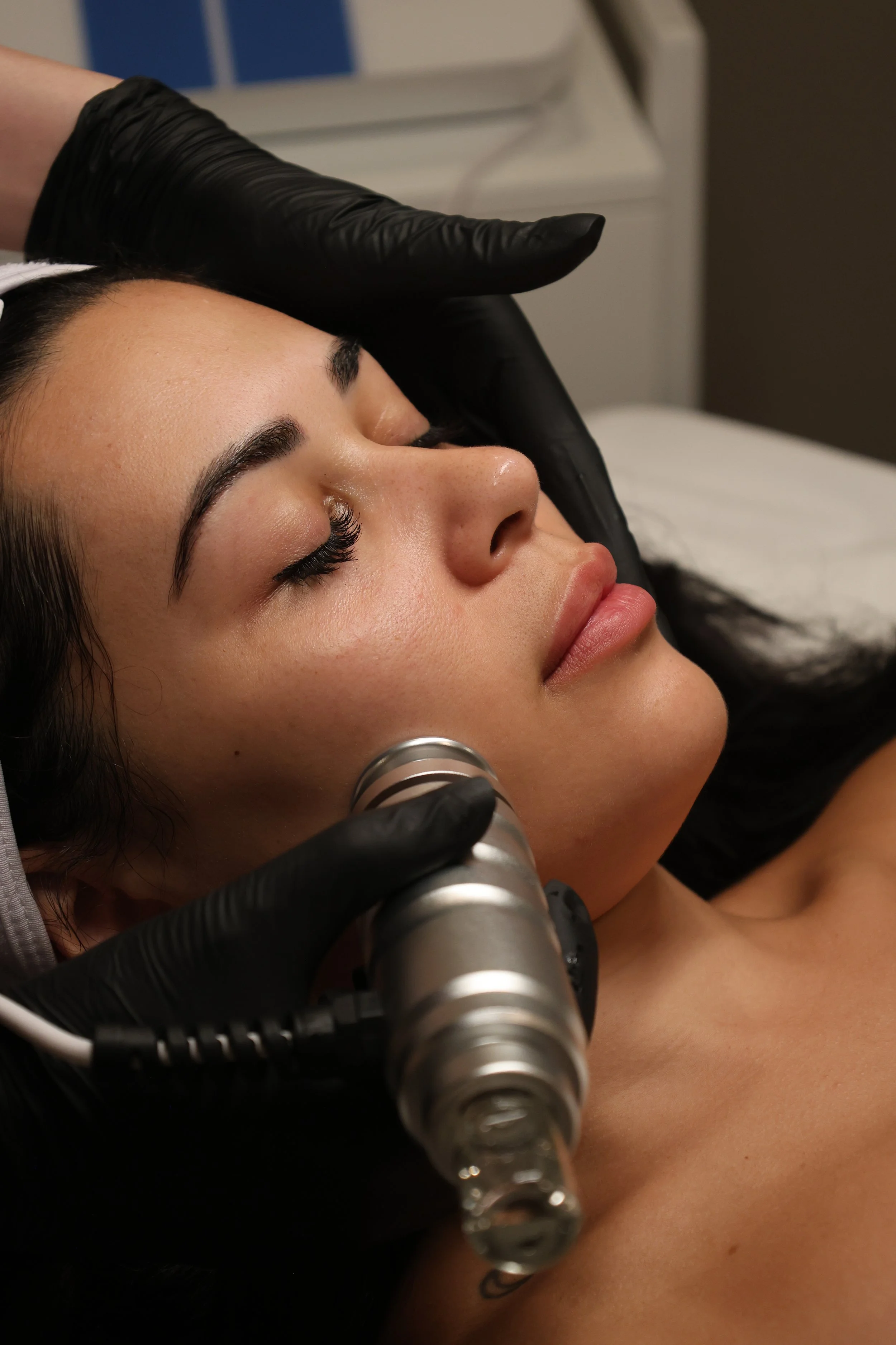 A woman lying down with her eyes closed during a cosmetic procedure, while a medical professional with gloved hands uses a specialized device near her cheek.