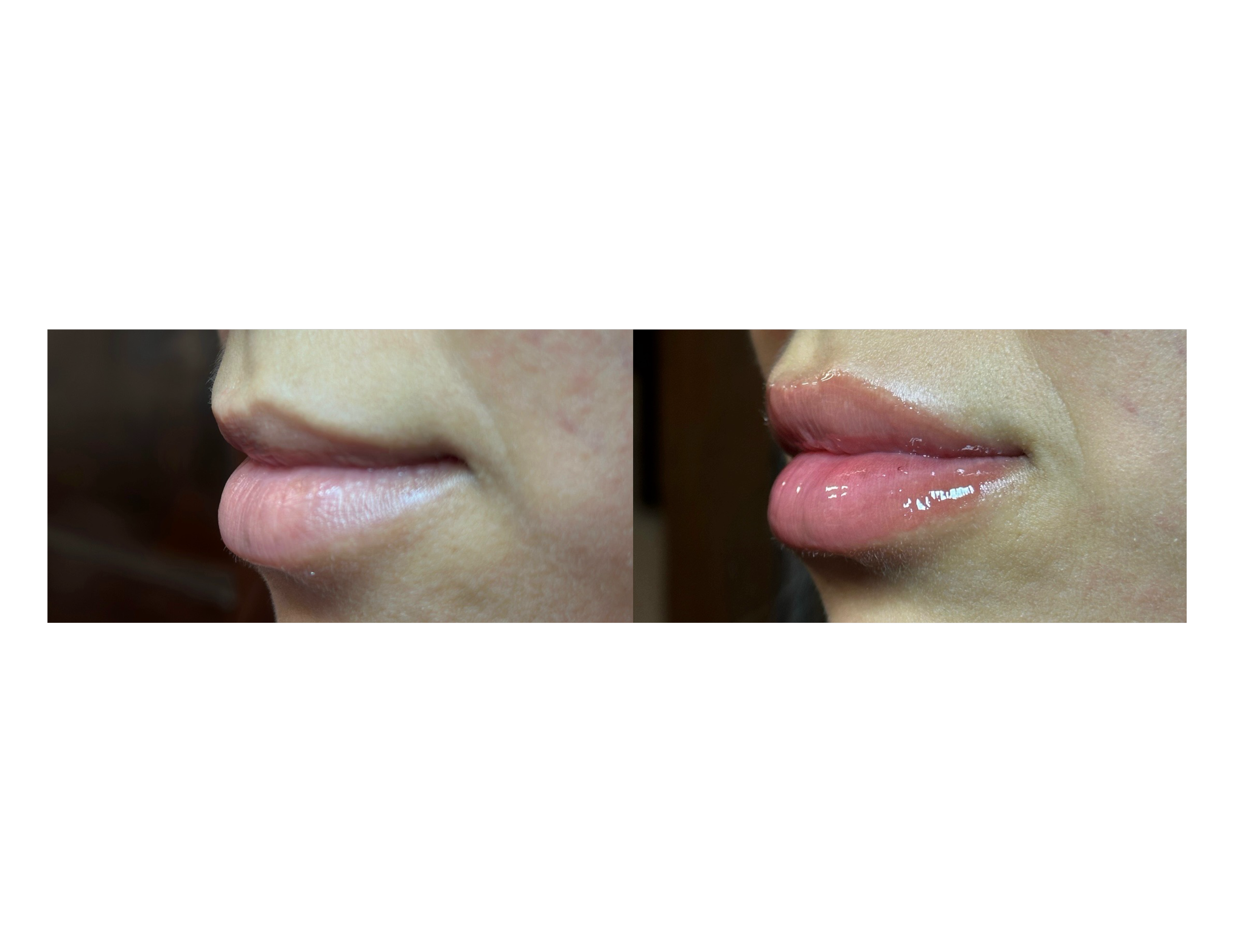Close-up of a person's lips, with the left side showing natural lips and the right side showing lips with pink lipstick and gloss.