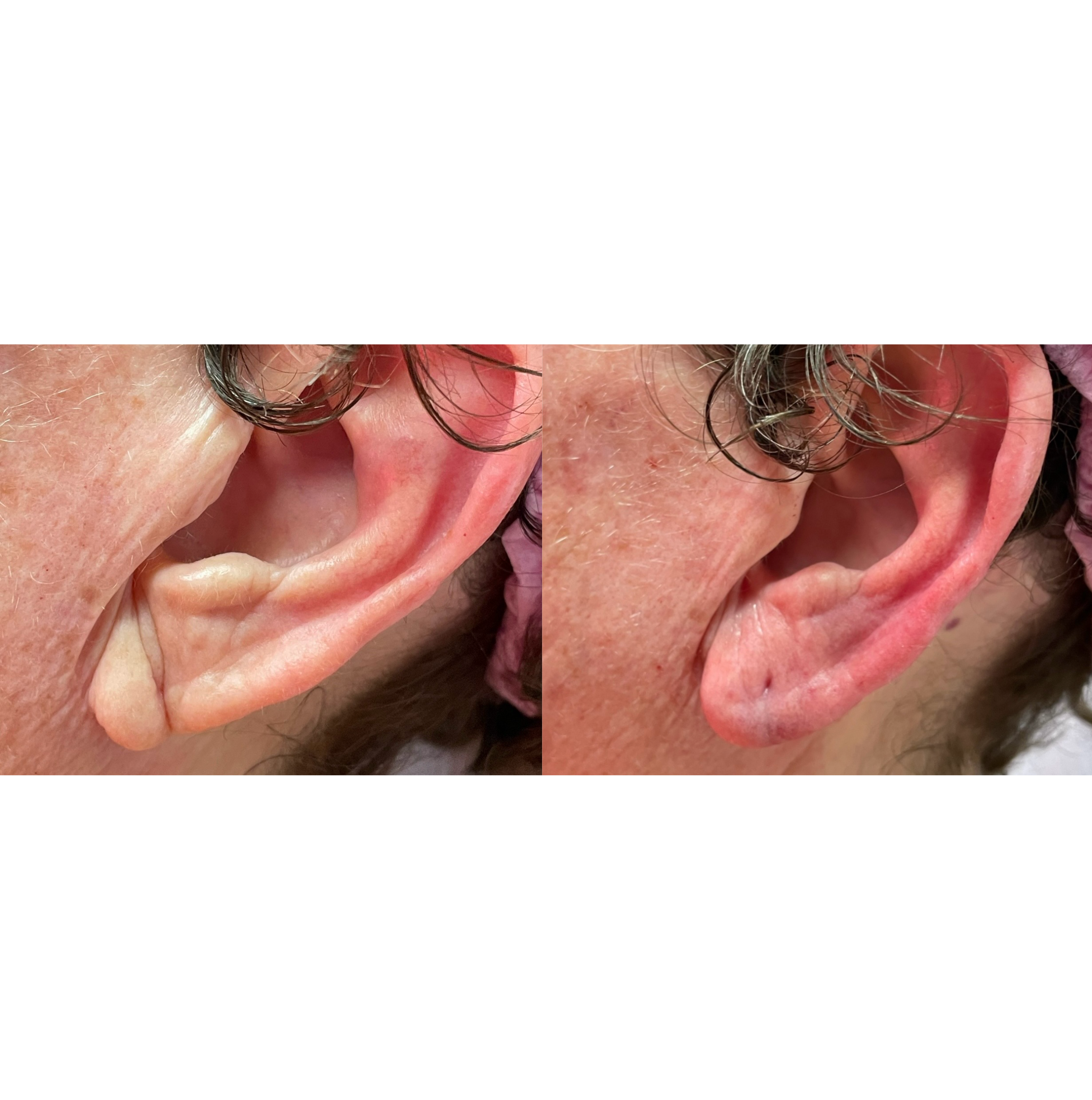 Close-up of a person's ear with wet, grayish hair and skin showing some redness.
