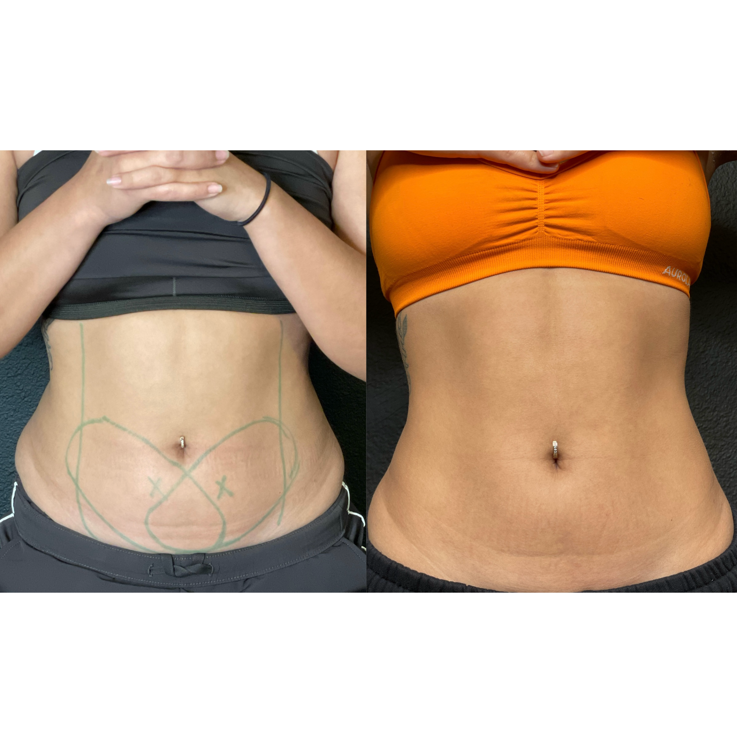 Side-by-side comparison of a woman's abdomen before and after fitness training: left side shows a relaxed midsection with green markings, right side displays a toned, muscular midsection wearing orange athletic shorts.