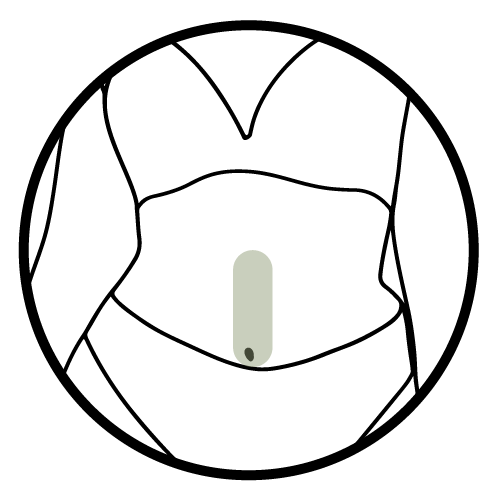 STOMACH STRIP