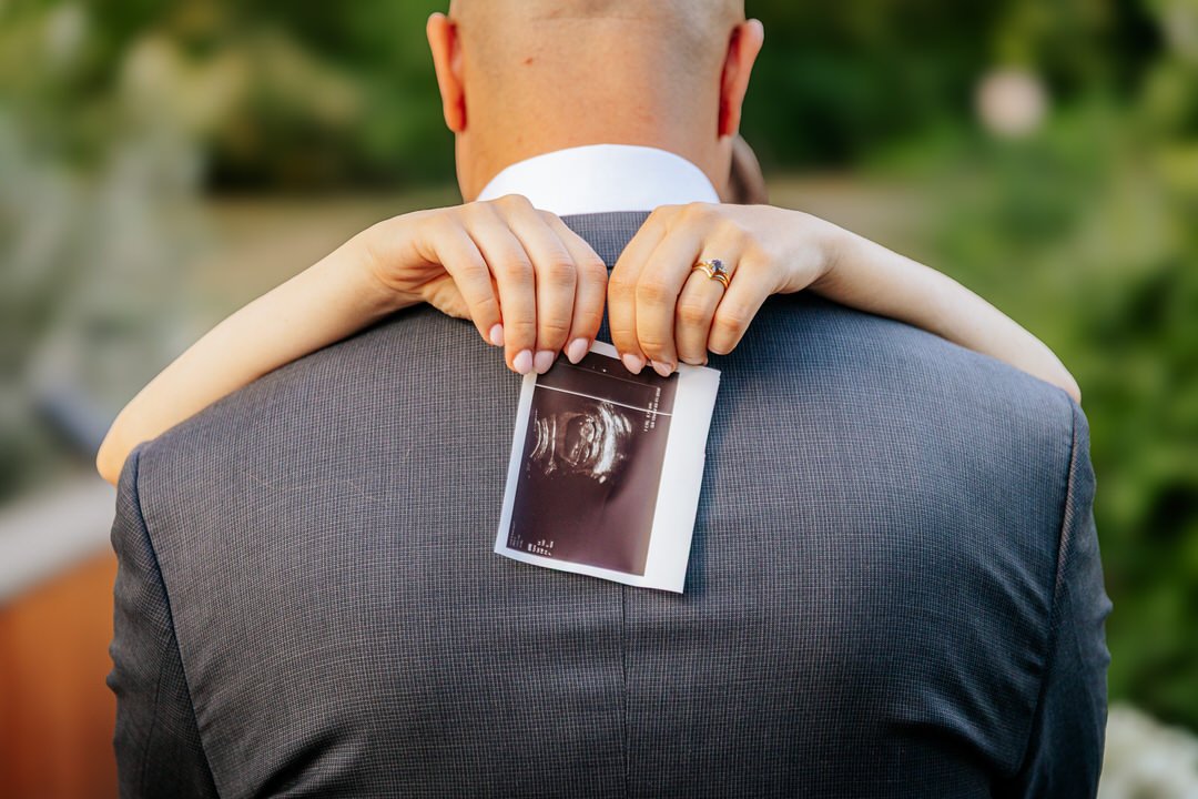 A person in a suit with a bald head on their back, with a woman's arms around their neck, holding an ultrasound image against their back.