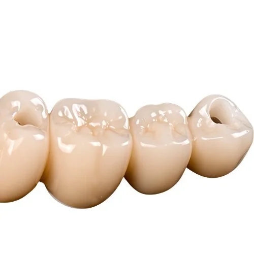 Zahnersatz Brücke Keramik Dental Fräszentrum präzise Zahntechnik Zahnarzt Labor