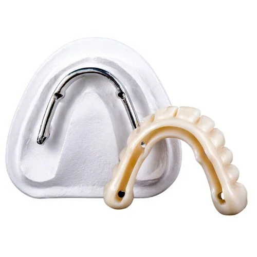 Stegprothese Zahnersatz Dental Fräszentrum Implantat Steg digitale Fertigung Zahnarzt Labor präzise Dentaltechnik