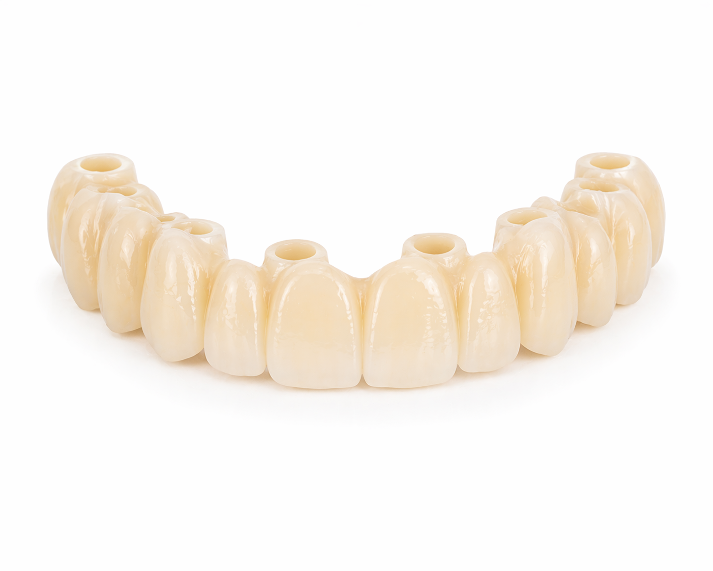 Zahnimplantat mit zwölf künstlichen Zähnen aus Veneers oder Keramik.
