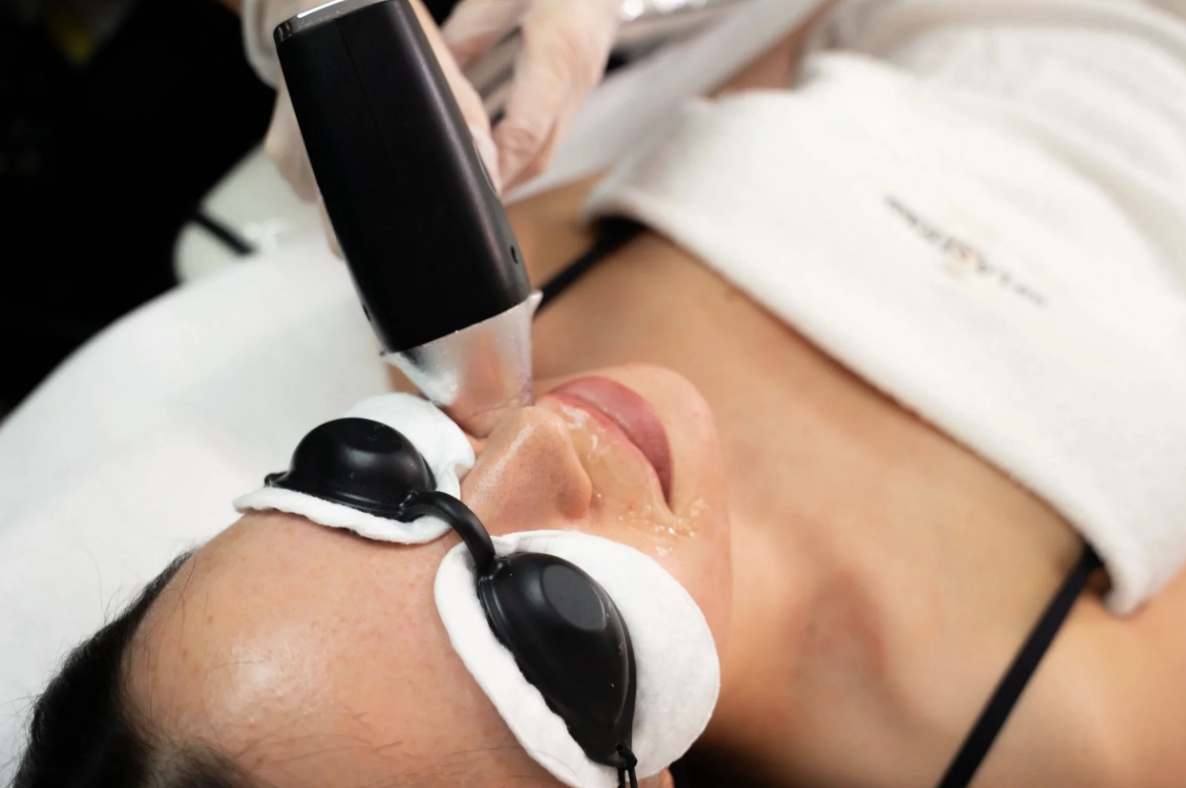 Why Train in Laser Hair Removal in 2026?